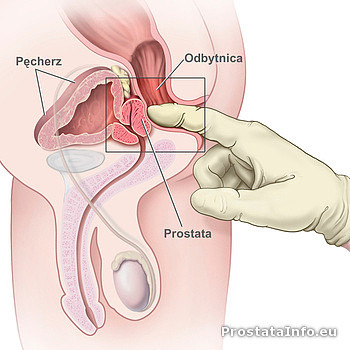 Badanie per rectum